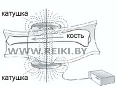 Заживление трещин электромагнитным полем